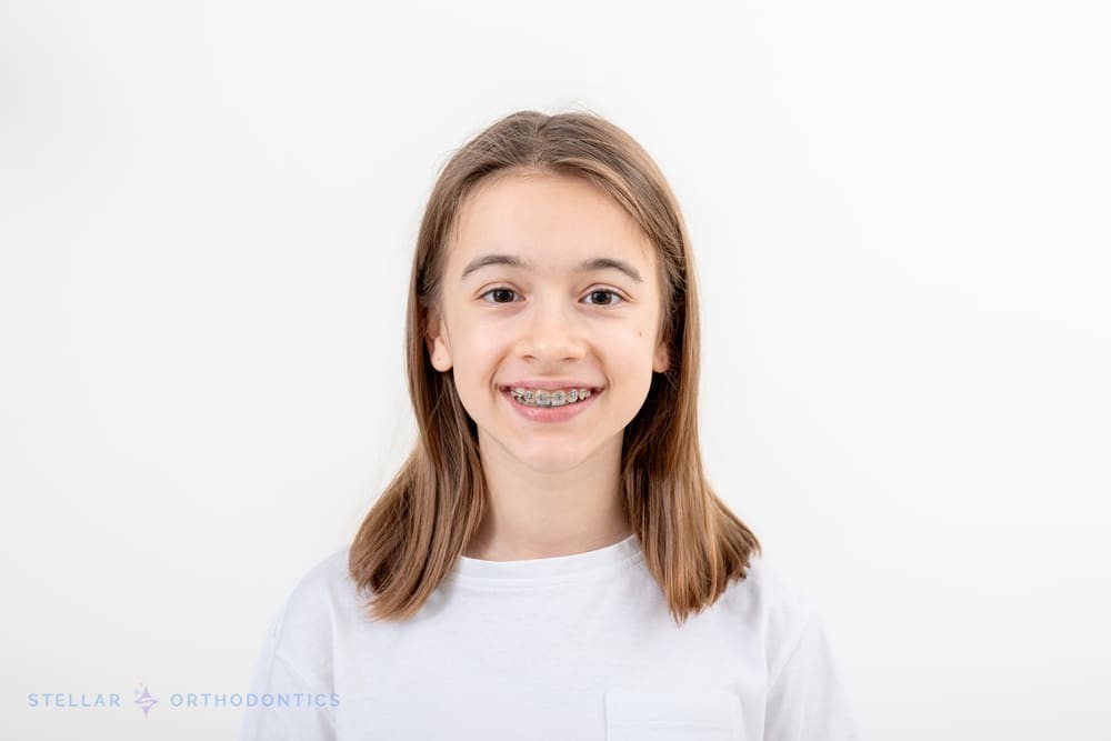 A smiling child with straight brown hair, wearing braces and a white T-shirt, stands against a plain white background—representing the results achieved at Stellar Orthodontics' braces for overbite in San Marcos, CA.