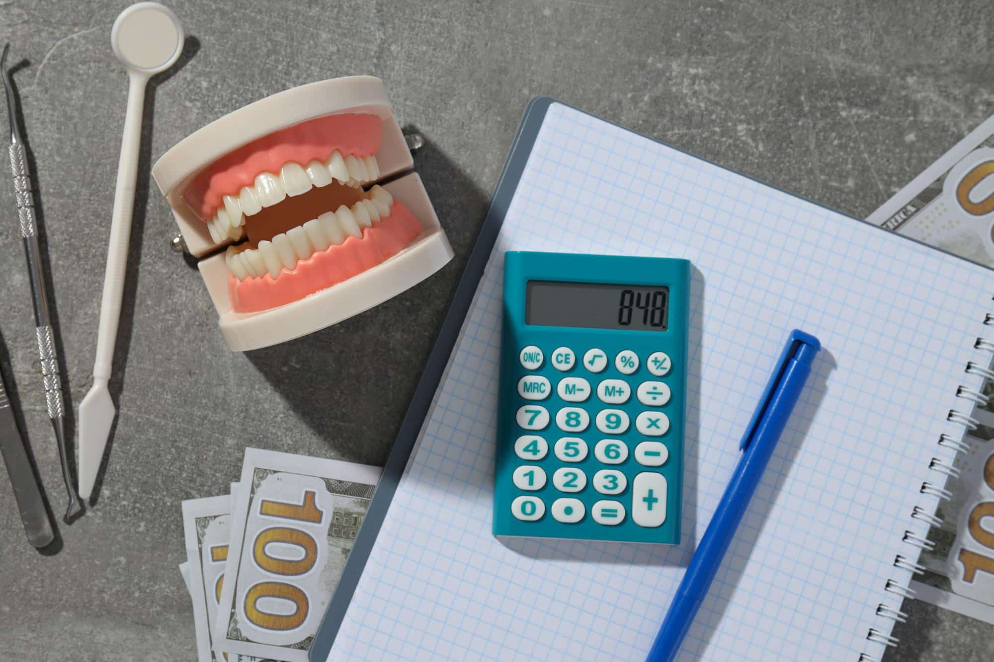On a gray surface in San Marcos, CA, displays a dental model, dental tools, cash, calculator (848), pen, and notebook. Represent about represent about Braces Payment Plan at Stellar Orthodontics.
