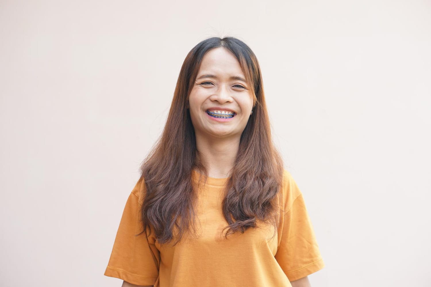 Smiling woman with long brown hair in an orange shirt shows metal braces at Stellar Orthodontics in San Marcos, CA.