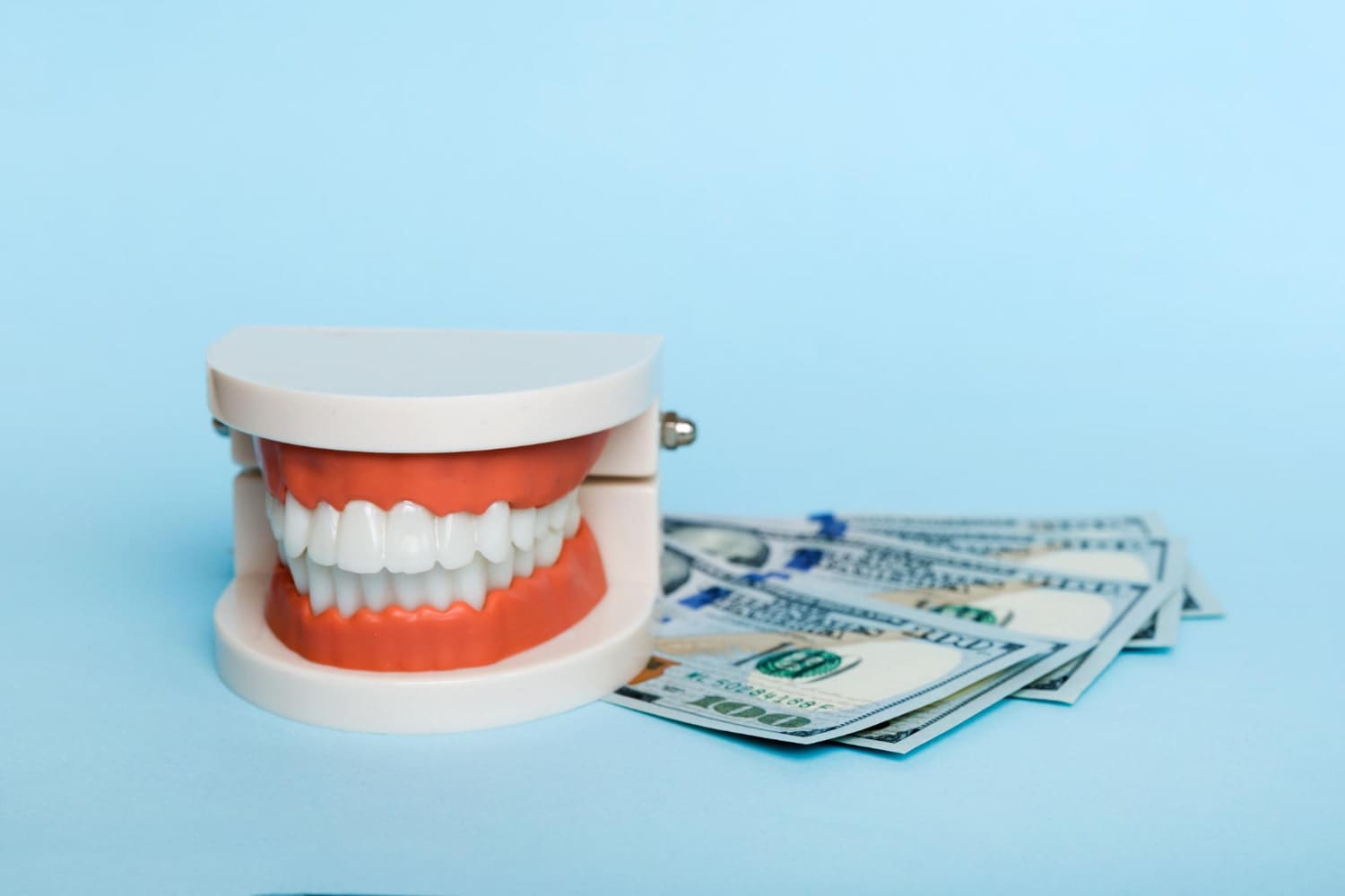 A dental model with metal braces and US hundred dollar bills, representing Stellar Orthodontics in San Marcos, CA, on blue.